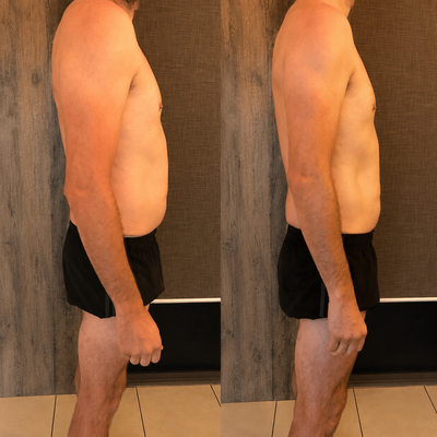 Grove® Lymphatic Drainage Drops