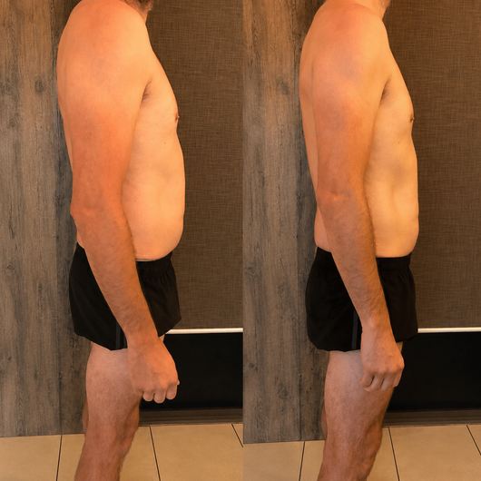 Grove® Lymphatic Drainage Drops